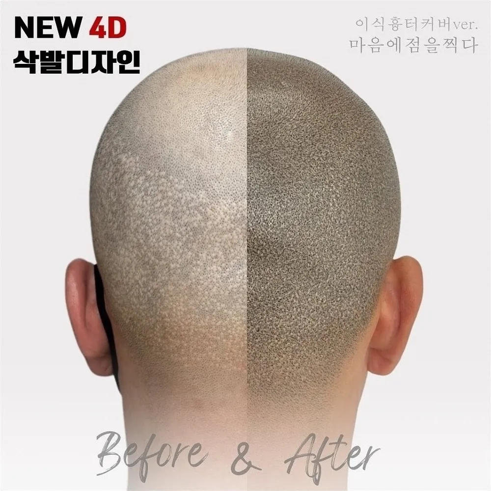전남 삭발·민머리 두피문신 사례